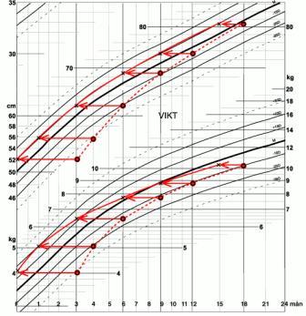 Övervikt/fetma och undervikt Vikt +/- 0,5-1 till längd - Viktigare än en enskild punkt - OBS viktökning utan motsvarande längdökning - Plötslig längdspurt (tidig pubertet) Bedömning av BVC-läkare