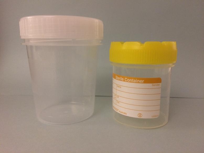 6 (23) Sputumburk och transportburk för sputum-odling, kan också användas för