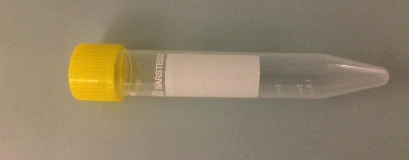 skruvlock + ytterburk Steril) Provrör med konisk botten för urinodling, sediment,