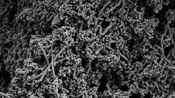 Infektion Immunbrist? Reflux? Rök? Avgaser?