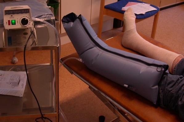 Intermittent kompression med pumpstöv Behandla ödem-de försämrar cirkulationen ytterligare.