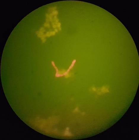 Figur 26 Prov med BTWO23a där ingen signal syns, en högre ordnings organism avger autofluorescens