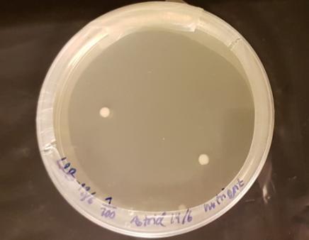 anaerobt V.