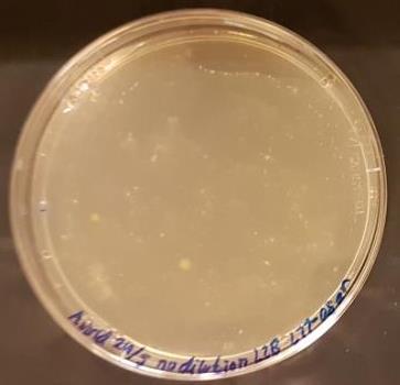 L11-agar Figur 65