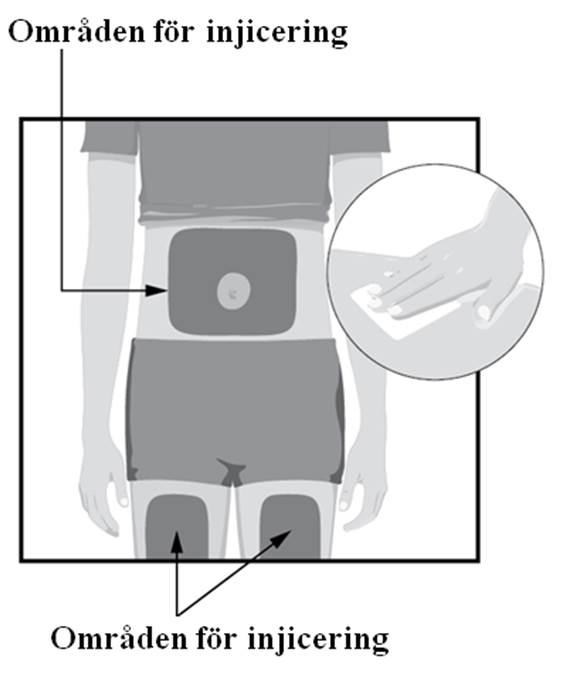 Injicera inte genom kläder Injicera inte i ett område där huden är öm, har blåmärke, röd, hård, ärrad, har bristningar eller i områden