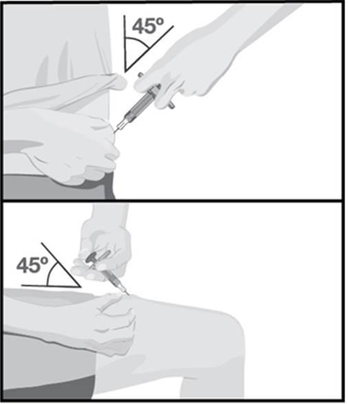Tryck in nålen hela vägen in i huden med en 45 graders vinkel med en snabb, kort rörelse. När nålen har kommit in, släpp taget om huden vid injektionsstället.