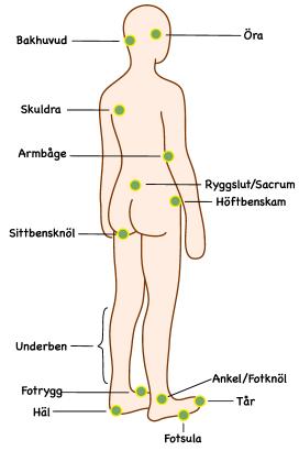 Såranamnes och sårstatus Tidigare sår Sårdebut