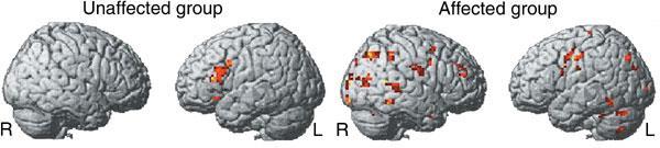 2012 by The Royal Society The area in the left hemisphere activated in 3-month-old infants by sentences with a mean duration of 2061 ms. Functional MRI study.