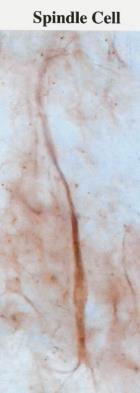 al., 2005, Nature Neuroscience Schoenemann et al.