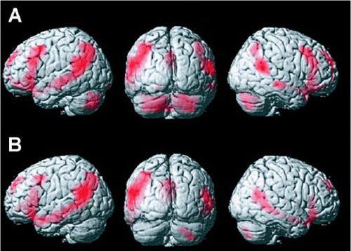 2012 by The Royal Society Wernicke - Geschwind The area in the left hemisphere activated in 3-month-old infants by sentences with a mean duration of 2061 ms.