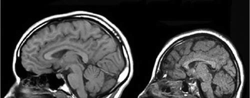 R DMPFC = höger dorsomediala prefrontala cortex R A.I. = höger anterior insula R Amyg = höger amygdala R Hyp = höger hypothalamus Rilling J K et. al. (2012) SCAN 7, 369-379.
