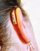 Öppna insatser an vänds främst vid lätt hörselned sätt ning. I vissa hörapparatmodeller sitter hög talaren i insatsen. Bakom-örat-apparater är den vanligaste typen av hörapparat.