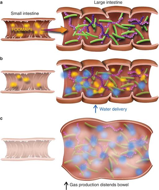 Features of the mechanisms of action of poorly absorbed short-chain carbohydrates (FODMAPs) for the development of gastrointestinal symptoms in FGID.