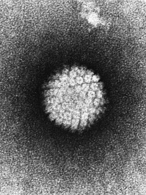 Vaccin Tre godkända vacciner i Sverige Gardasil Cervarix Gardasil-9 6 11 16 18 31 33 45 52 58