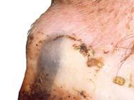 derma ) Derma