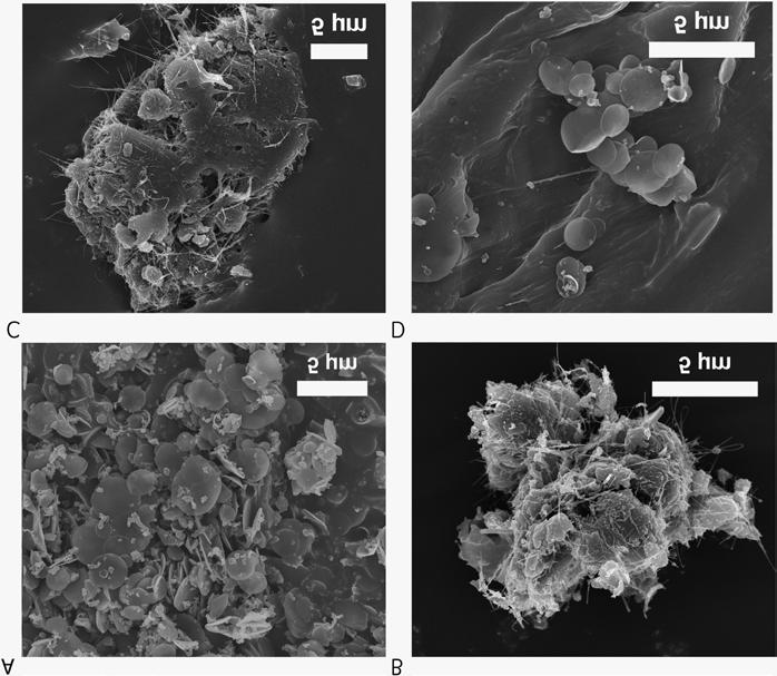 (a) (b) Figur 3. SEM-bilder av ytkontamintion av kolbaserade nanomaterial. (a) Kolnnanodiscar från ett tejpprov insamlat i produktionslaboratoriet.