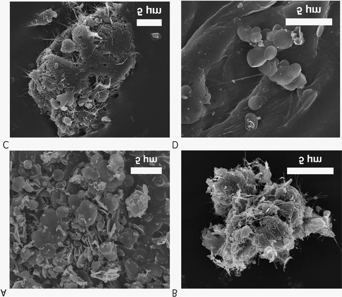 (a) (b) Figur 3. SEM-bilder av ytkontamintion av kolbaserade nanomaterial. (a) Kolnnanodiscar från ett tejpprov insamlat i produktionslaboratoriet.