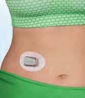 Dexcom (från G5 Mobile och framåt) är godkänt för att fatta behandlingsbeslut på sensorvärdet, vilket innebär att du i de flesta fall kan minska mängden blodsockermätningar.
