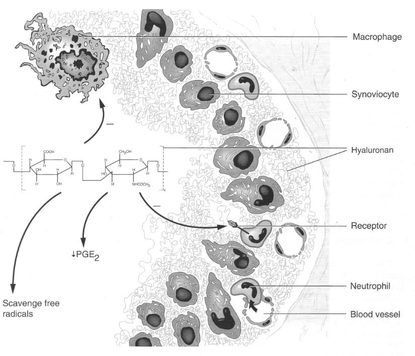 Figur 5: Hyaluronsyrans antiinflammatoriska egenskaper i en inflammerad led; som exogen molekyl och i synovialmembran. Hyaluronsyra hämmar bl.a. prostaglandiner, makrofager och neutrofiler och kan förstöra fria syreradikaler.