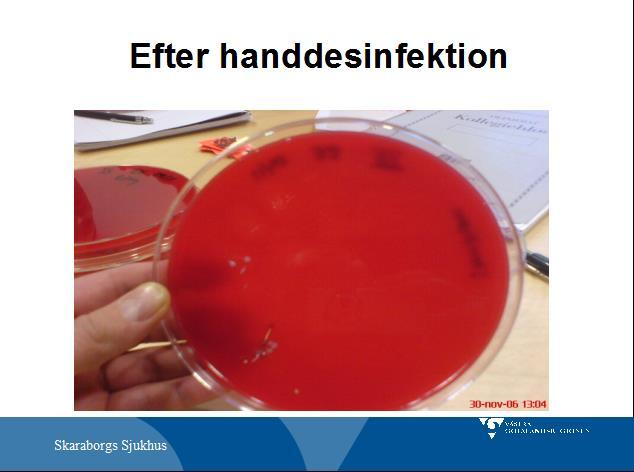 Kommentar: Efter handdesinfektion är bakterierna nästan helt eliminerade.
