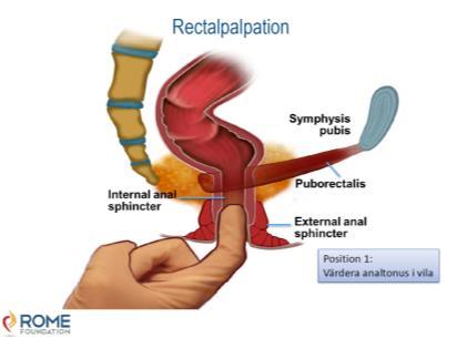 perianalt prineum vaginalt Neurologi