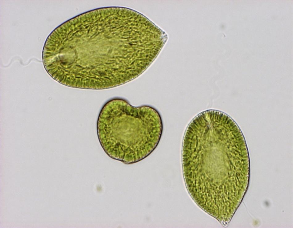 Figur 19. Slemmet från Gonyostomum semen kan täppa till gälar hos kräftor. Foto: Gertrud Cronberg. Gonystomum semen upptäcktes för första gången i Sverige 1948 (Sörensen, 1954).