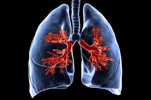 Många blir sjuka av förorenad luft KRONISK OBSTRUKTIV LUNGSJUKDOM HJÄRT- KÄRLSJUKDOMAR BARNASTMA VUXENASTMA LUNGCANCER