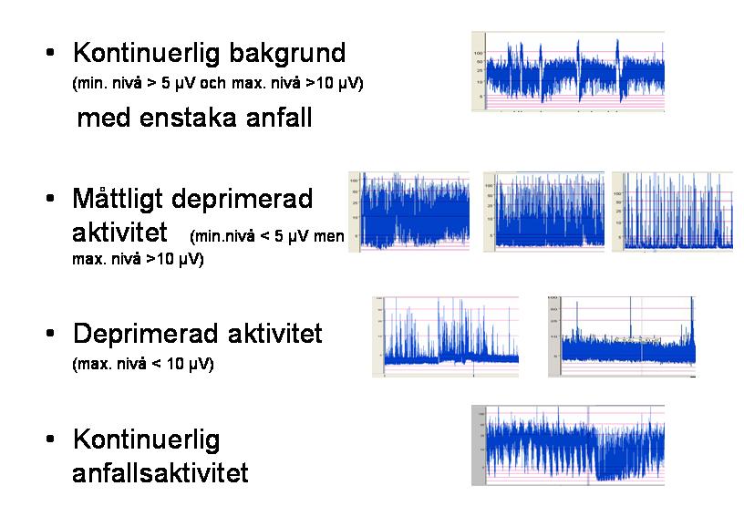 Riktlinjer för initial aeeg-tolkning med TOBY kriterier Bilaga 1 Giltig version är