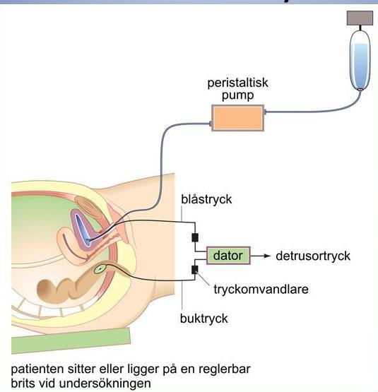 Urodynamik Utvidgad undersökning för att se hur urinblåsan reagerar på blåsfyllnad. Utförs i Falun av uroterapeut tillsammans med gynekolog.