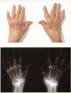 Patient Clinical Presentation with Corresponding Radiographs Length of