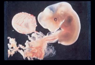 Risker vid fosterbestrålning 0-10 dagar efter befruktning Hög strålkänslighet, men skador medför troligen spontan abort Dag 10-60 Period med dominerande organogenes.