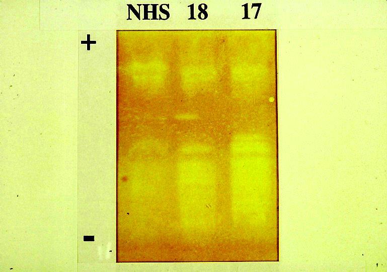 Analys av C3NeF Hemolytisk test osensibiliserade fårblodkroppar (Rother U, 1982) MAC