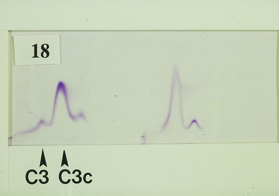 C3-nedbrytning i fluid phase med