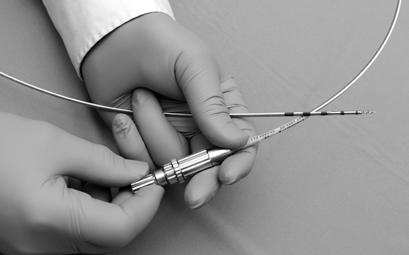 ENDODRILL BIBBINSTRUMENTS TEKNOLOGI Dagens metoder Ett välkänt kliniskt problem inom sjukvården har varit att vid endoskopisk vävnadsprovtagning av submukösa tumörer samla tillräckligt med adekvat