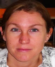 Jenny Nilsson Livssituationen hos unga som haft barncancer- en longitudinell studie Åsa