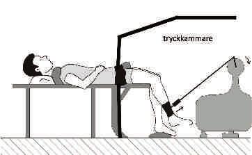 Figur 1. Träningsmodell för enbensträning med och utan minskat blodflöde till den arbetande muskulaturen. jämfört med träning med normalt blodflöde.
