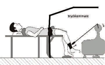 Figur 1. Träningsmodell för enbensträning med och utan minskat blodflöde till den arbetande muskulaturen. jämfört med träning med normalt blodflöde.