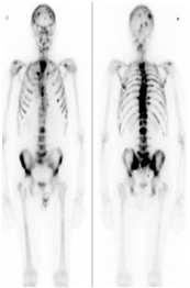 detection and classification