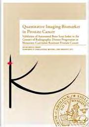 Xofigo (Alva et al, 2017) Tasquinimode (Armstrong et al, 2018) BSI