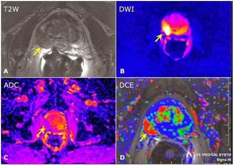 Magnetkamera (MRI) för att