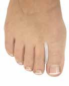 Art nr 7651 97:- 1 st Tå-avlastare hallux Gelkudde som skyddar ömmande fotknöl. Passar både höger & vänster fot.