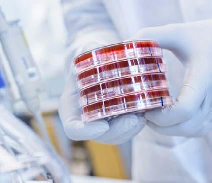 6 STÖD FORSKNING OM GLOBAL HÄLSA STÖD FORSKNING OM GLOBAL HÄLSA 7 Individorienterad medicin skapar nya förutsättningar Vi saknar idag verktyg för att avgöra hur varje individ som drabbats av sepsis