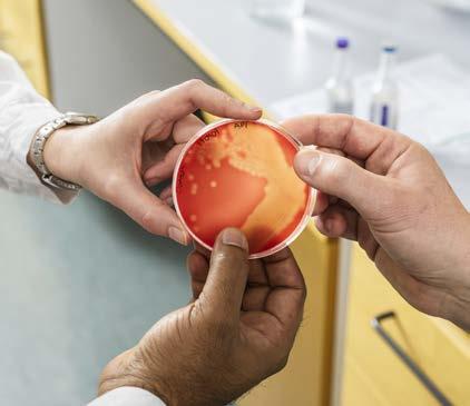 10 STÖD FORSKNING OM GLOBAL HÄLSA STÖD FORSKNING OM GLOBAL HÄLSA 11 Vad händer när bakterie möter cell? Vad händer i det allra första ögonblicket när en bakterie möter en människocell?