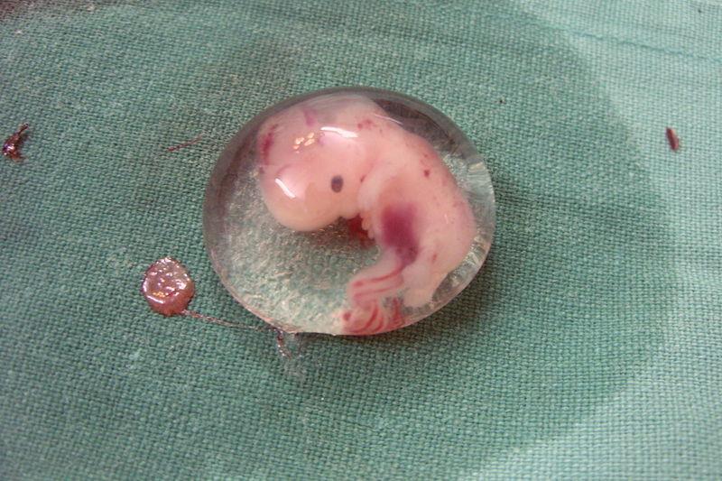 Embryo 6v