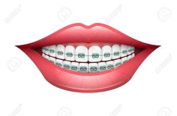 ortodontiassistenter fördelar sig