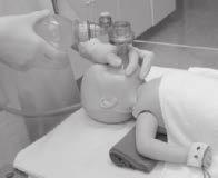 1 PRIMÄRT OMHÄNDERTAGANDE OCH NEONATAL HLR minskas något om eventuellt mekonium i luftstrupen avlägsnas innan övertrycksventilation inleds.