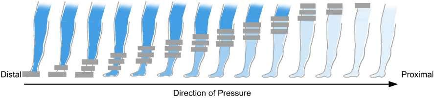 Lympha Press manschetter till underkroppen Lympha Press Optimal V2 Lympha Press Byxmanschett i två storlekar Byxmanschetten används av personer med benödem och/eller ödem i höfter och magregion.