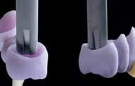 Tryck ut IPS e.max CAD Crystall./ Glaze pasta ur sprutan och blanda. Applicera IPS e.max CAD Crystall./Glaze pasta i ett jämnt skikt på restaurationens yttre ytor.