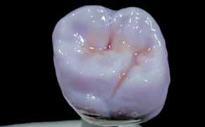 /Shades Shade Incisal 1 Shade Incisal 2 Shade 0 Shade 1 Shade 2 Shade 3 Shade 4 IPS e.max CAD Crystall.