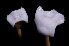 max CAD Crystall./Glaze pasta och kristallisering och Stain/Glaze bränning görs i ett steg. Karaktäriseringarna appliceras med IPS e.max CAD Crystall./ Shades och Stains.